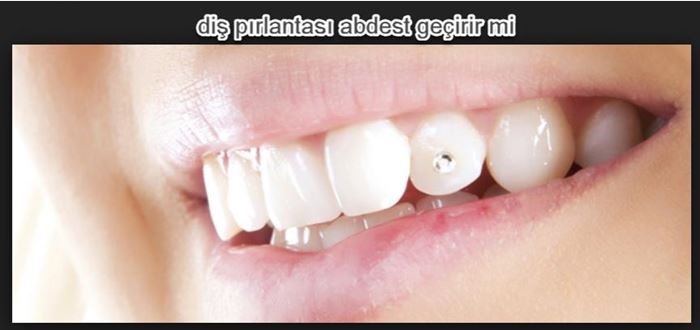 Dişe takılan pırlanta veya taş ile gusül abdesti kabul olunurmu
